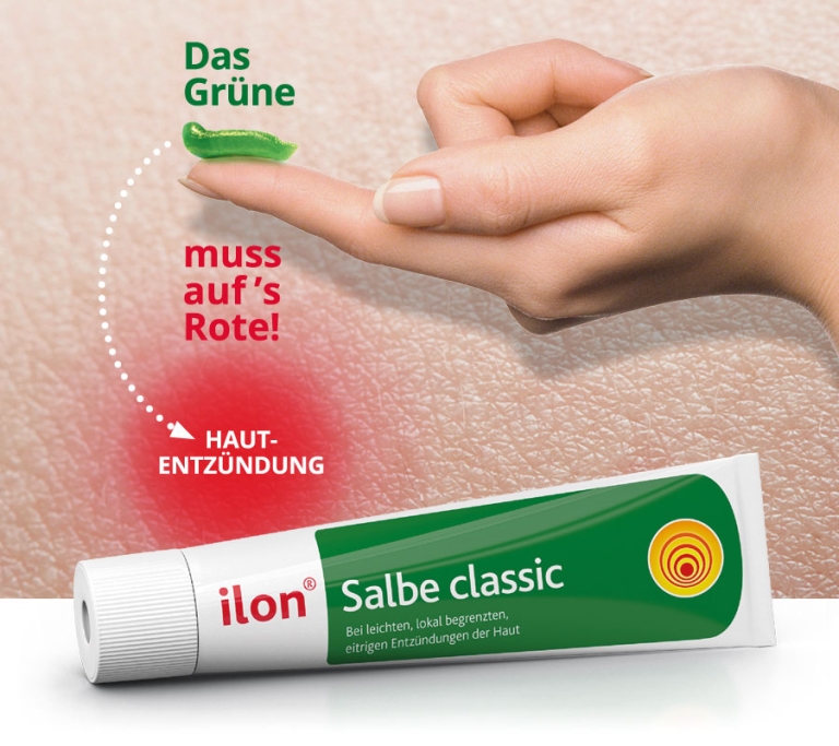 ilon Salbe classic Zugsalbe für kleinere Abszesse ilon.de