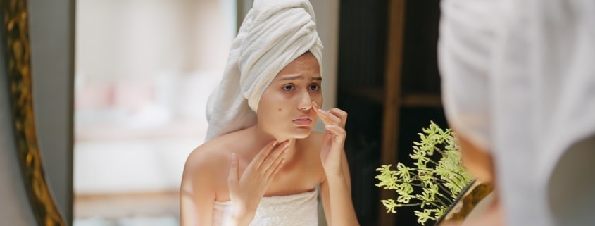 Junge Frau im Bad mit einem sichtbaren Pickel im Gesicht